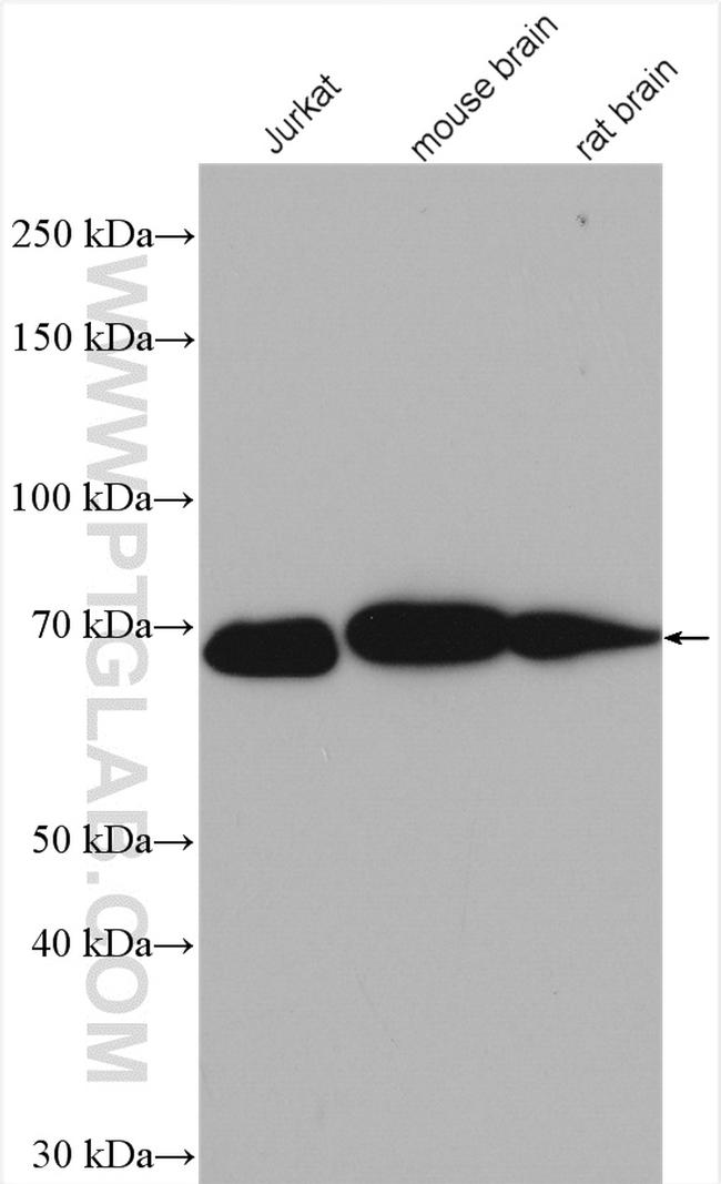 LZTS1 Antibody in Western Blot (WB)