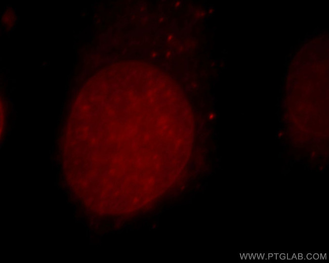 CUL4B Antibody in Immunocytochemistry (ICC/IF)