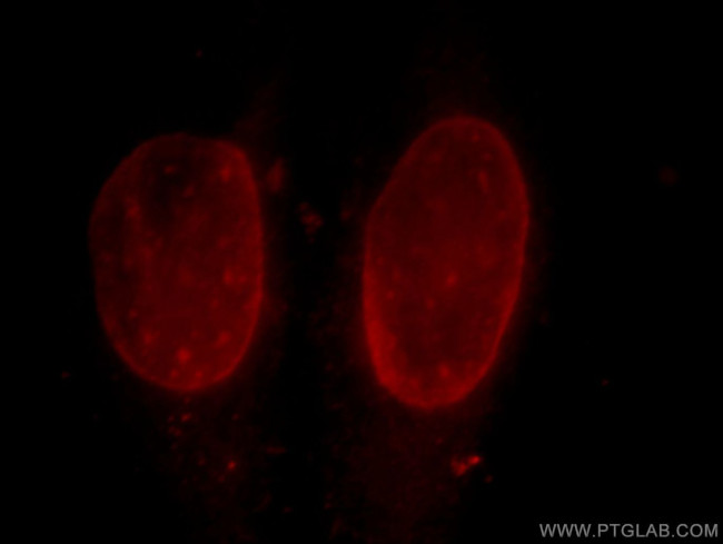 CUL4B Antibody in Immunocytochemistry (ICC/IF)