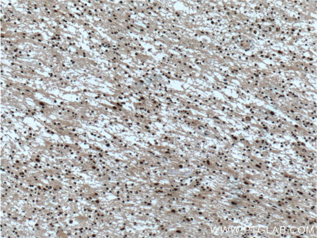 CUL4B Antibody in Immunohistochemistry (Paraffin) (IHC (P))