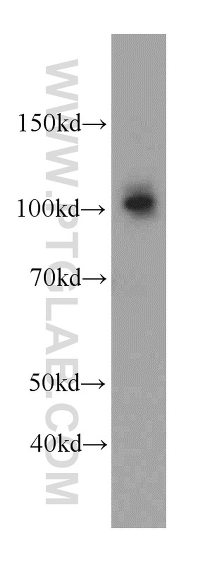 CUL4B Antibody in Western Blot (WB)