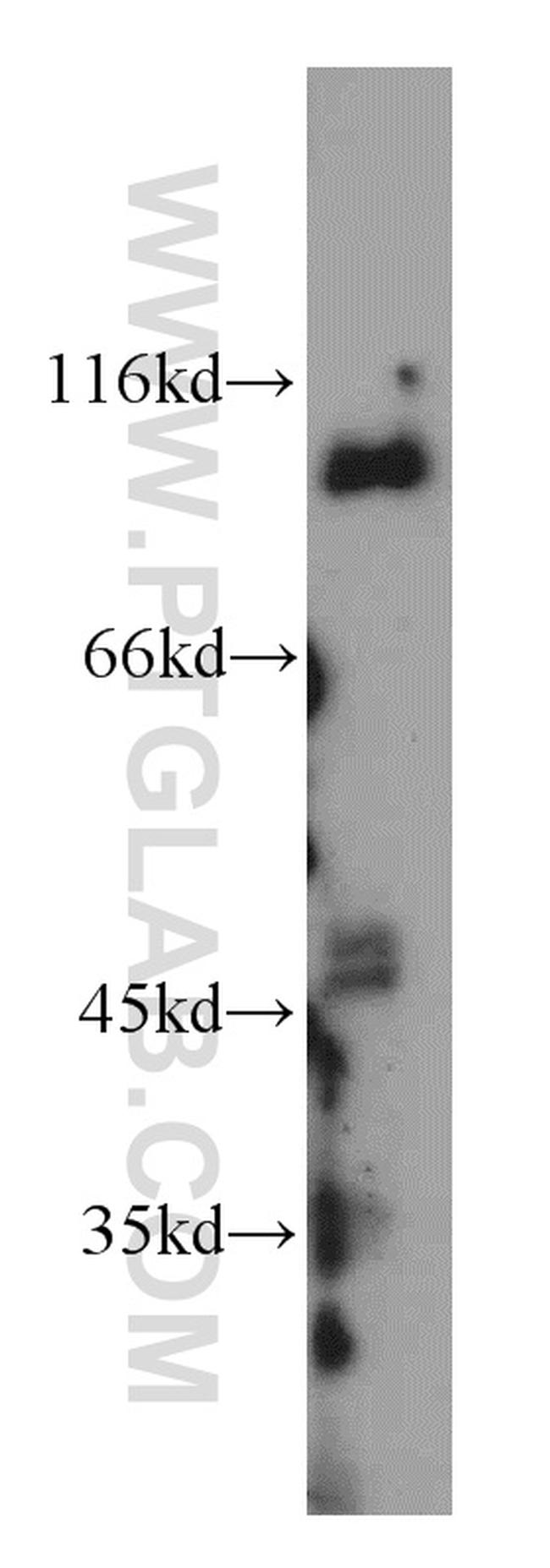 CUL4B Antibody in Western Blot (WB)