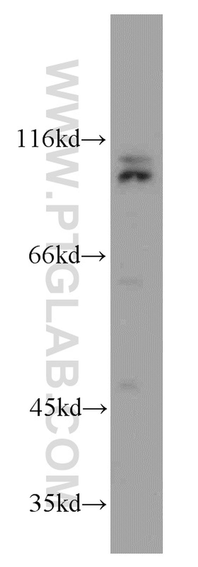 CUL4B Antibody in Western Blot (WB)