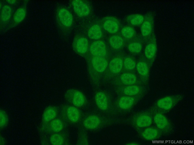 CUL4B Antibody in Immunocytochemistry (ICC/IF)