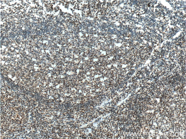 CUL4B Antibody in Immunohistochemistry (Paraffin) (IHC (P))