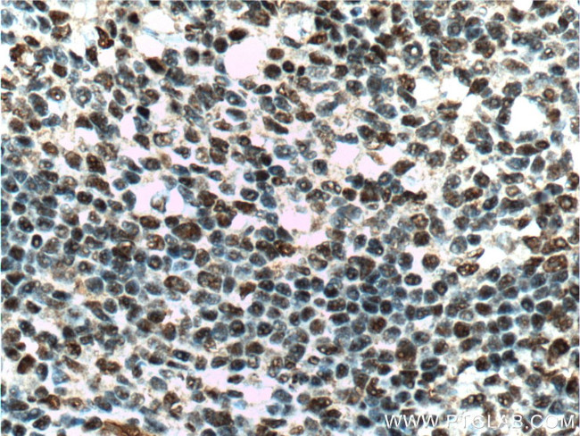 CUL4B Antibody in Immunohistochemistry (Paraffin) (IHC (P))