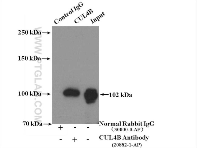 CUL4B Antibody in Immunoprecipitation (IP)