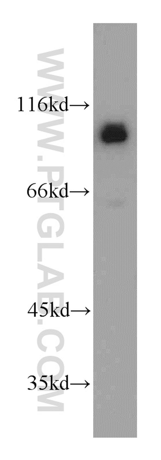 CUL4B Antibody in Western Blot (WB)