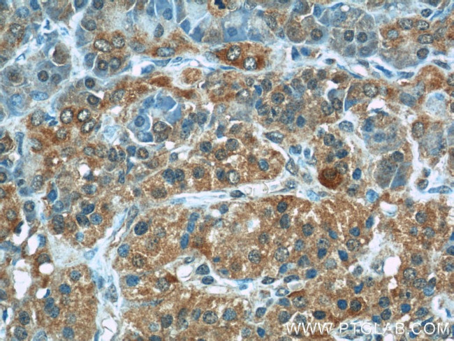 EPHB4 Antibody in Immunohistochemistry (Paraffin) (IHC (P))