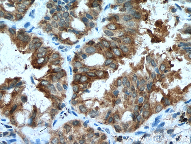 EPHB4 Antibody in Immunohistochemistry (Paraffin) (IHC (P))