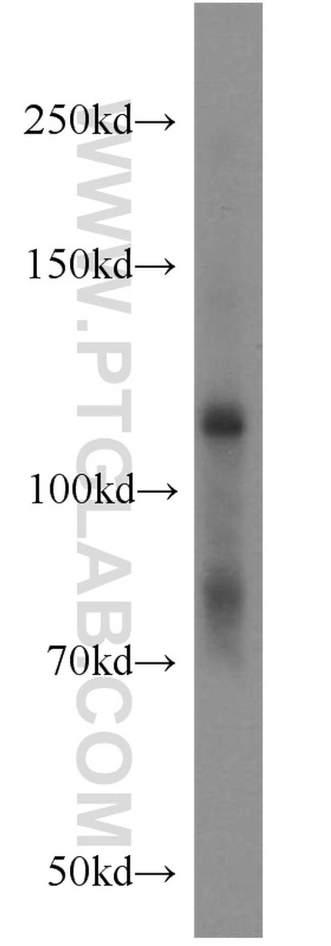 EPHB4 Antibody in Western Blot (WB)