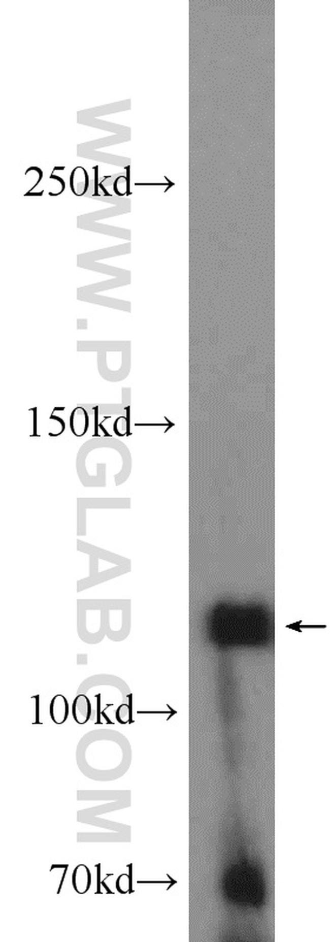 EPHB4 Antibody in Western Blot (WB)