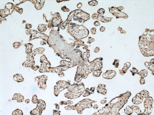 EPHB4 Antibody in Immunohistochemistry (Paraffin) (IHC (P))