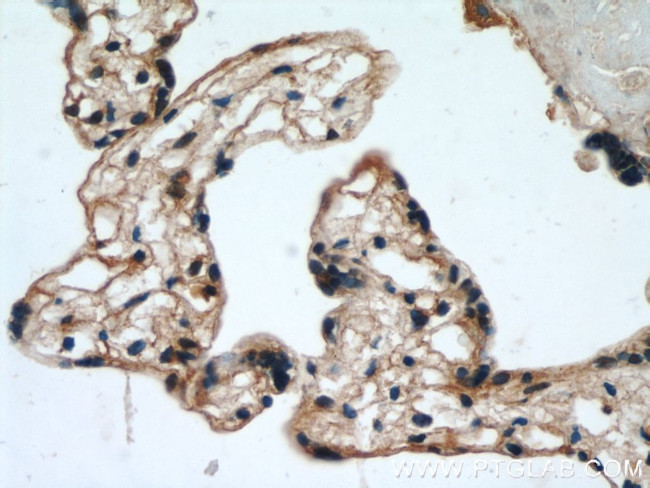 EPHB4 Antibody in Immunohistochemistry (Paraffin) (IHC (P))