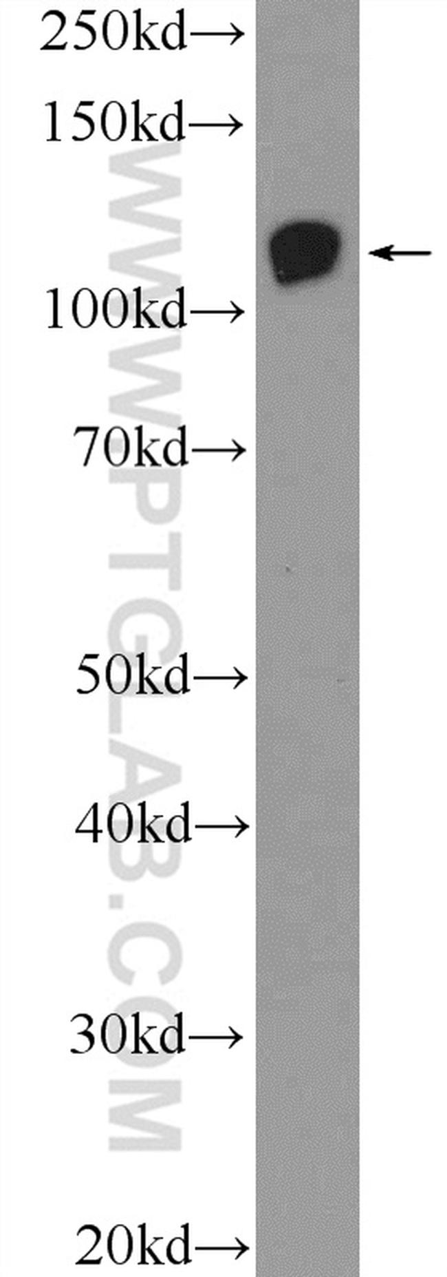 EPHB4 Antibody in Western Blot (WB)