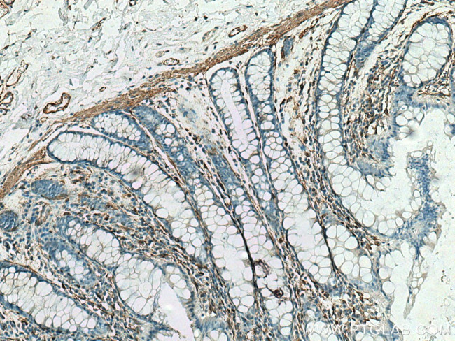 Caldesmon Antibody in Immunohistochemistry (Paraffin) (IHC (P))