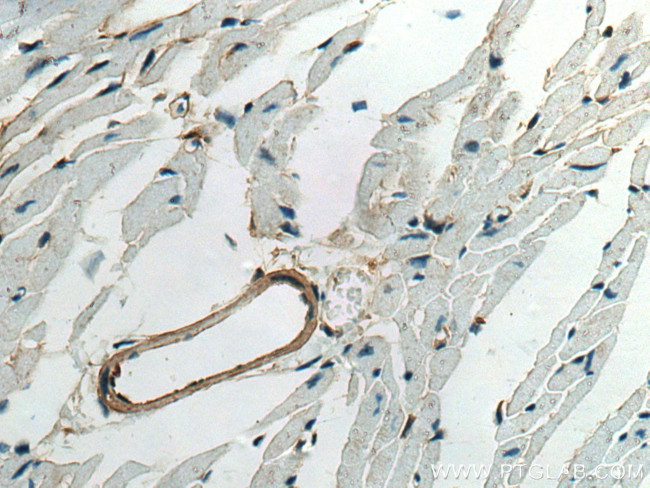 Caldesmon Antibody in Immunohistochemistry (Paraffin) (IHC (P))