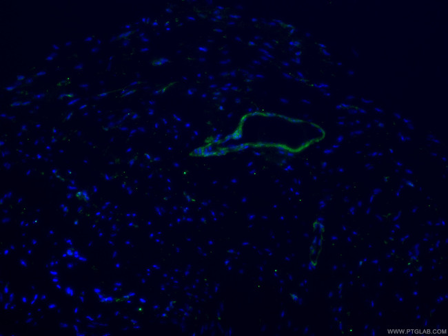 Caldesmon Antibody in Immunohistochemistry (PFA fixed) (IHC (PFA))