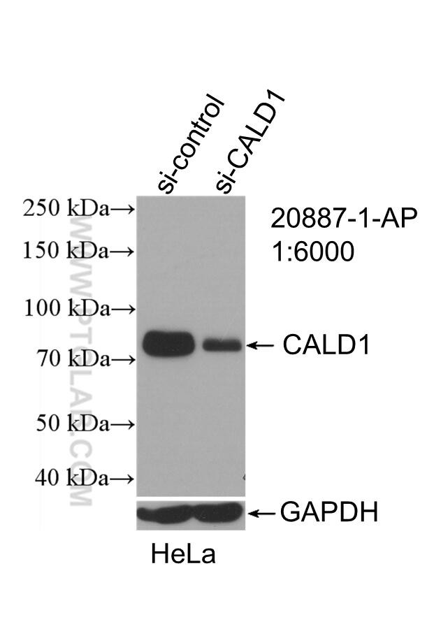 Caldesmon Antibody in Western Blot (WB)