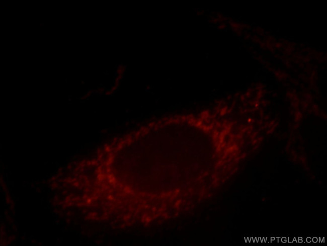 Caldesmon Antibody in Immunocytochemistry (ICC/IF)