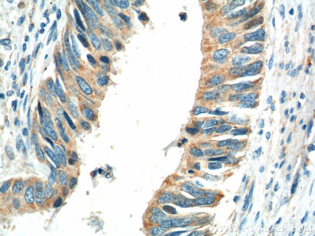 Caldesmon Antibody in Immunohistochemistry (Paraffin) (IHC (P))