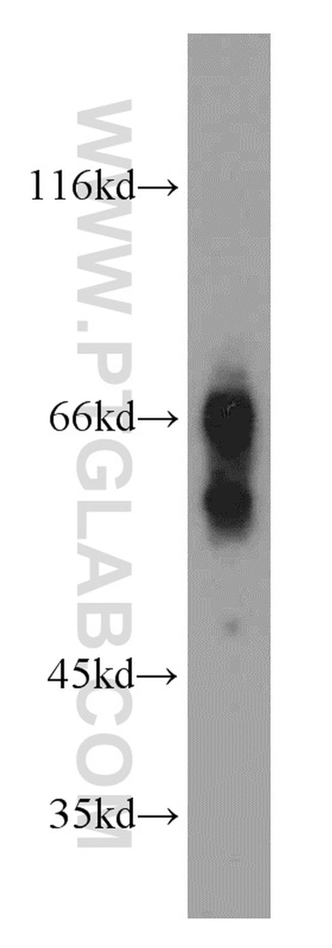 Caldesmon Antibody in Western Blot (WB)