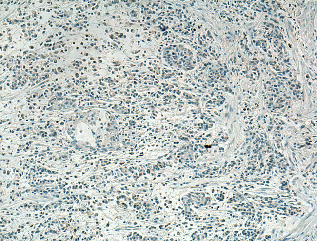 SLC16A4 Antibody in Immunohistochemistry (Paraffin) (IHC (P))