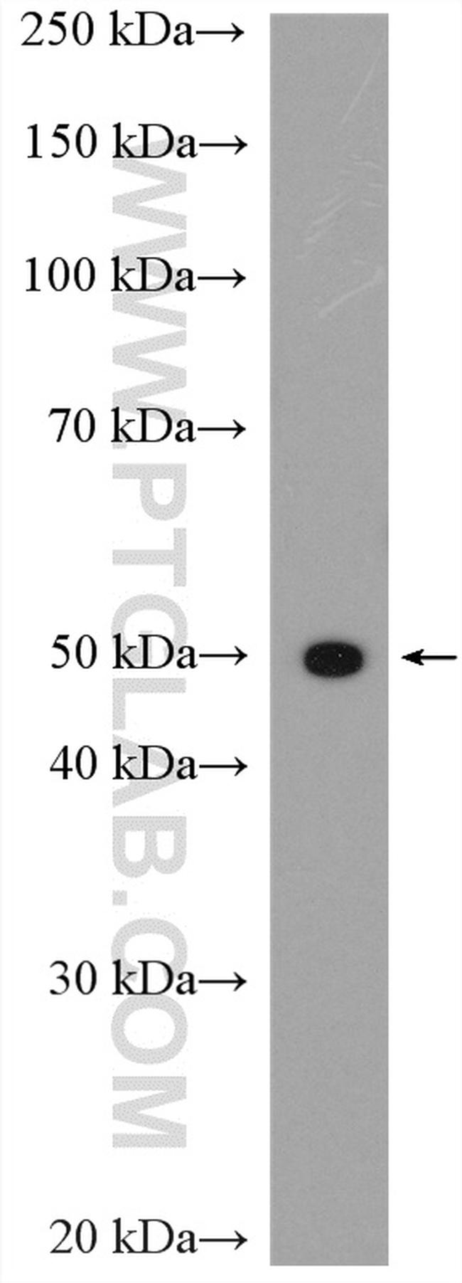 SLC16A4 Antibody in Western Blot (WB)