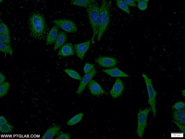 SEC23IP Antibody in Immunocytochemistry (ICC/IF)