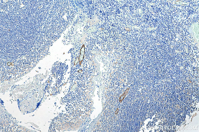 E-selectin /CD62E Antibody in Immunohistochemistry (Paraffin) (IHC (P))