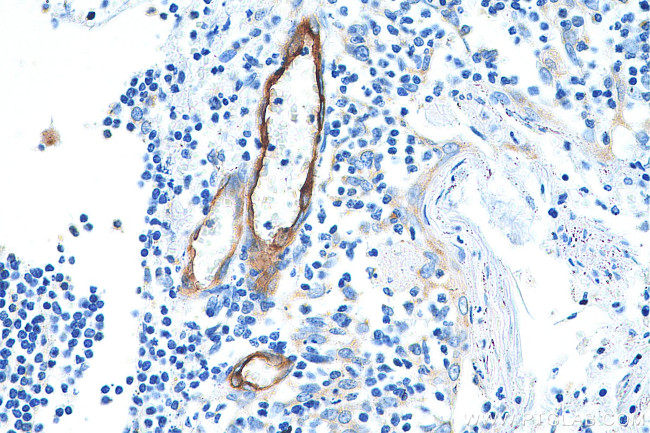 E-selectin /CD62E Antibody in Immunohistochemistry (Paraffin) (IHC (P))