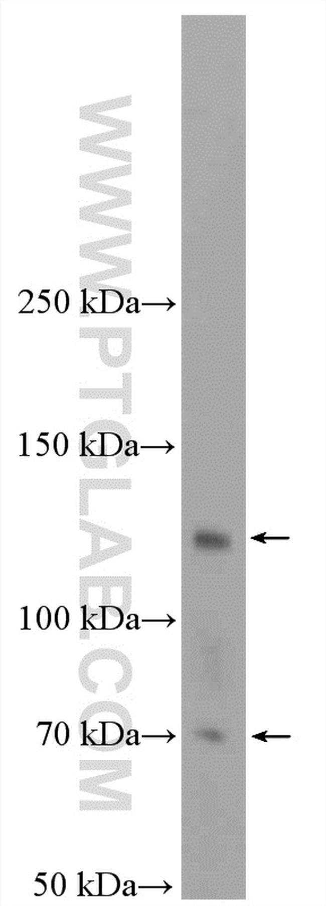 E-selectin /CD62E Antibody in Western Blot (WB)