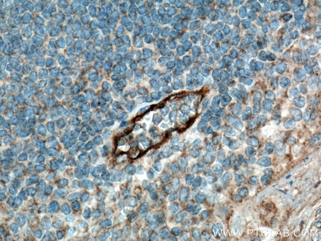 E-selectin /CD62E Antibody in Immunohistochemistry (Paraffin) (IHC (P))