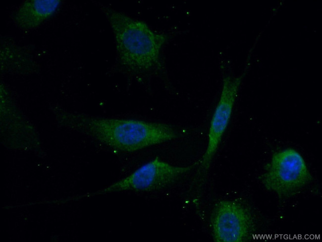 BRAF Antibody in Immunocytochemistry (ICC/IF)