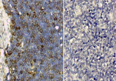 Transferrin Antibody in Immunohistochemistry (IHC)