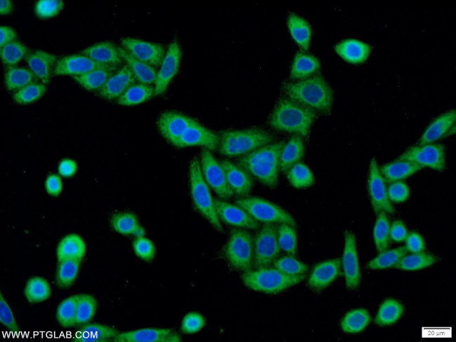 C3orf21 Antibody in Immunocytochemistry (ICC/IF)