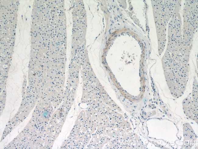 WDR37 Antibody in Immunohistochemistry (Paraffin) (IHC (P))