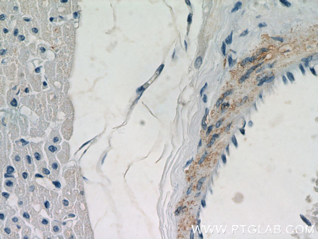 WDR37 Antibody in Immunohistochemistry (Paraffin) (IHC (P))