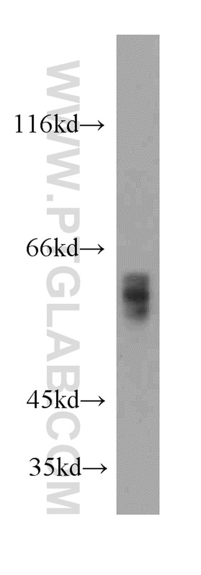 WDR37 Antibody in Western Blot (WB)