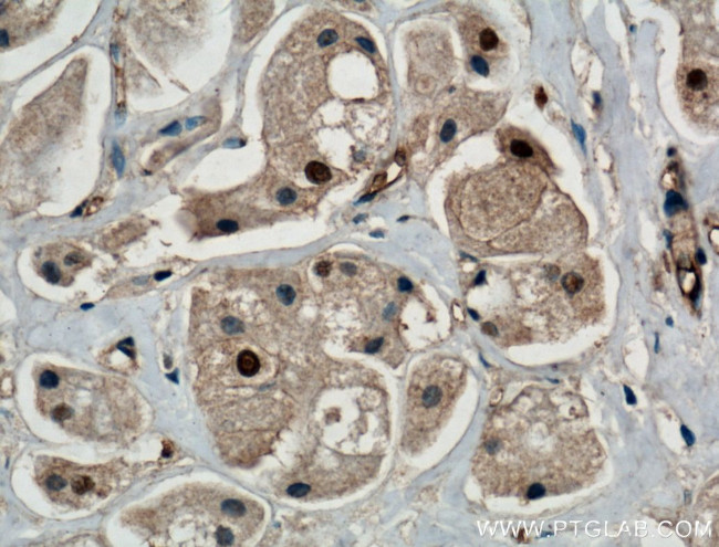 ITCH Antibody in Immunohistochemistry (Paraffin) (IHC (P))