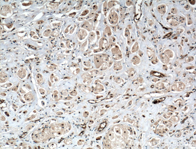 ITCH Antibody in Immunohistochemistry (Paraffin) (IHC (P))