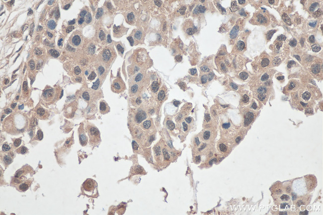 ITCH Antibody in Immunohistochemistry (Paraffin) (IHC (P))