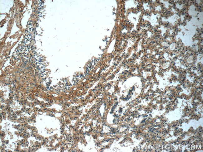 PTAFR Antibody in Immunohistochemistry (Paraffin) (IHC (P))