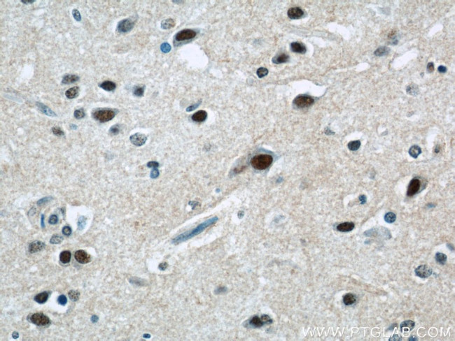 ZNF597 Antibody in Immunohistochemistry (Paraffin) (IHC (P))