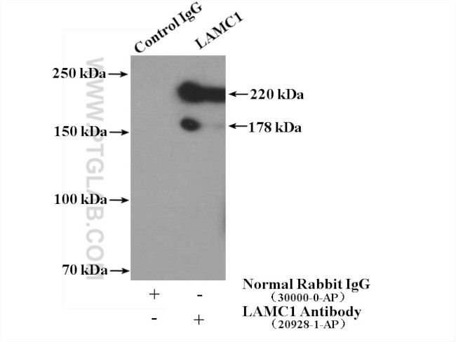 LAMC1 Antibody in Immunoprecipitation (IP)