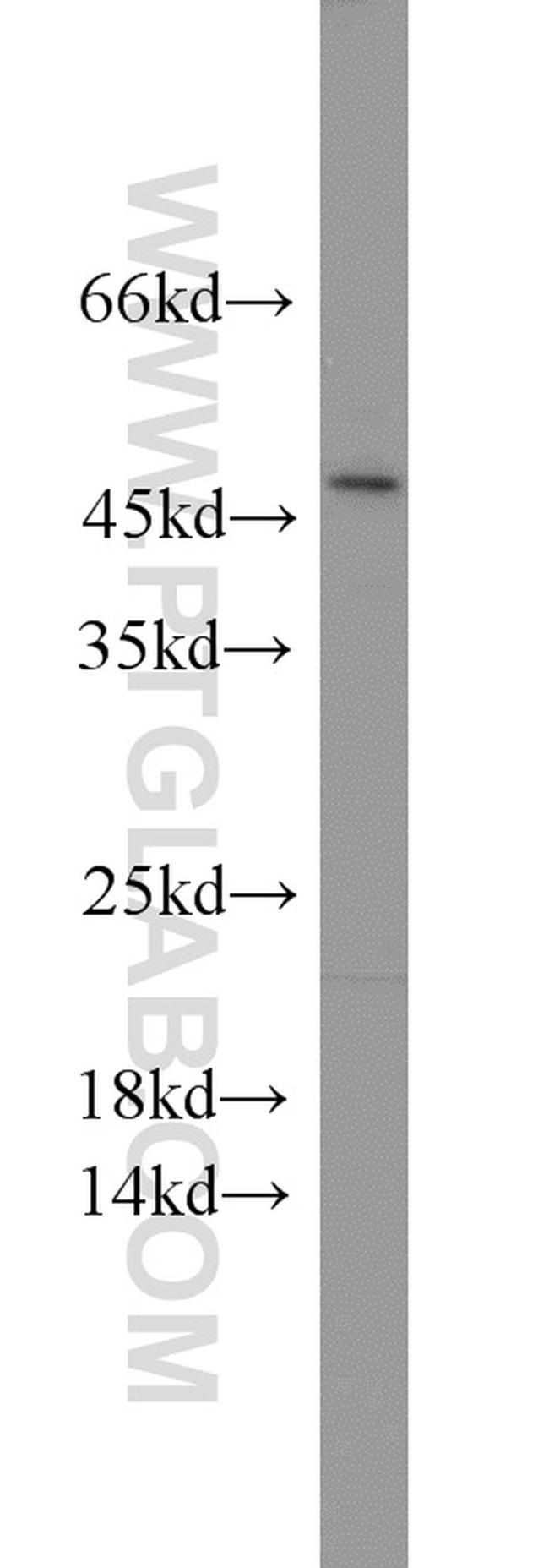 BEND5 Antibody in Western Blot (WB)