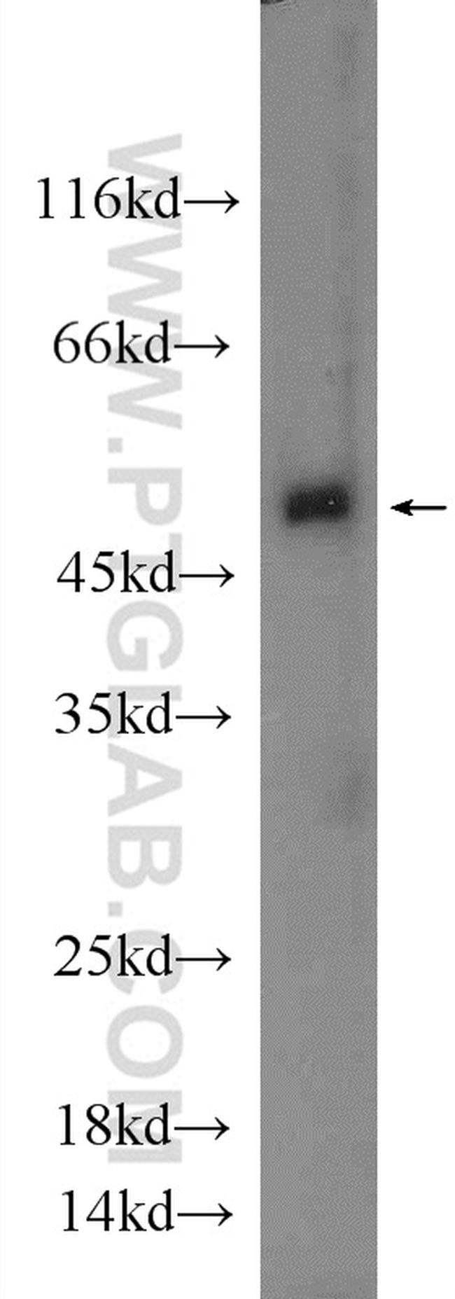 BEND5 Antibody in Western Blot (WB)