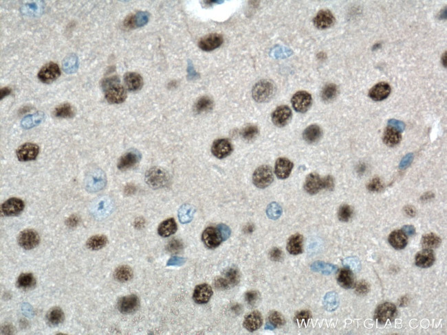 TBR1 Antibody in Immunohistochemistry (Paraffin) (IHC (P))