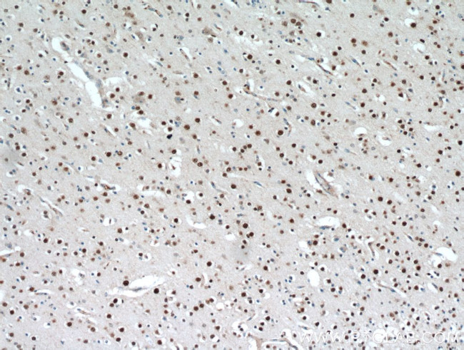 TBR1 Antibody in Immunohistochemistry (Paraffin) (IHC (P))