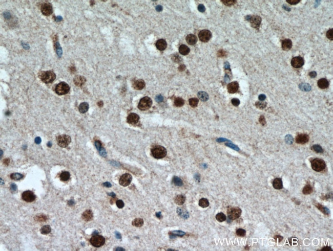 TBR1 Antibody in Immunohistochemistry (Paraffin) (IHC (P))